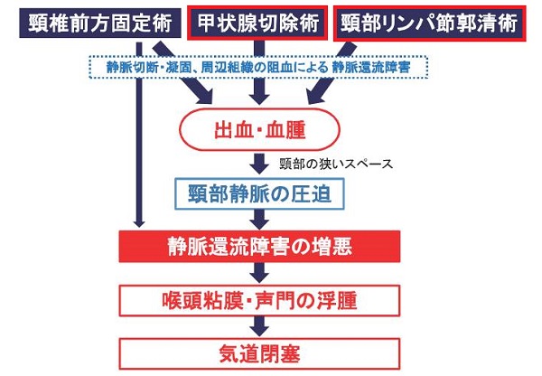 甲状腺摘出後喉頭浮腫のメカニズム 甲状腺摘出後喉頭浮腫のメカニズム