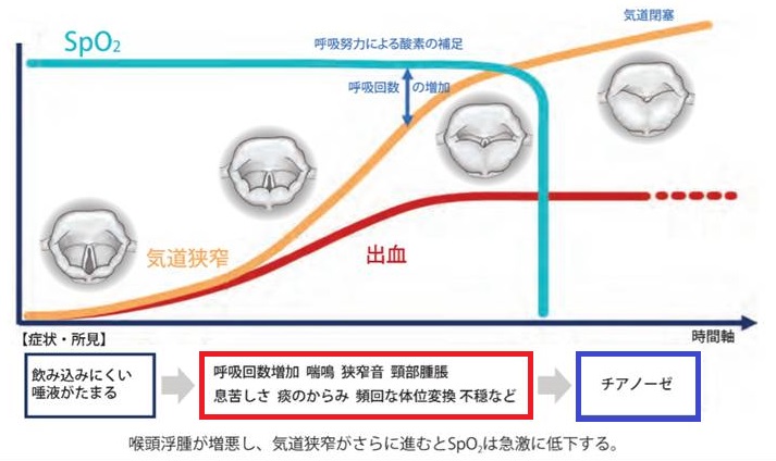 甲状腺摘出後喉頭浮腫 急変直前までSpO2は低下しない 甲状腺摘出後喉頭浮腫 急変直前までSpO2は低下しない