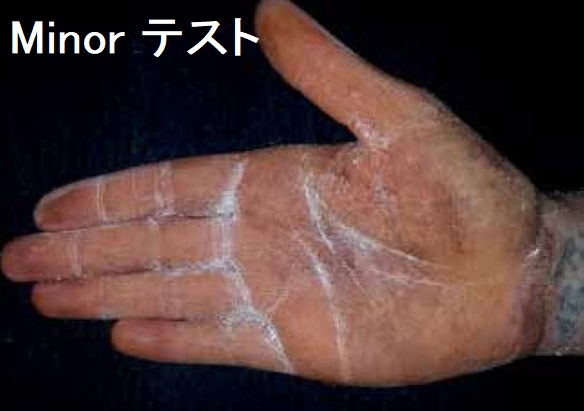 Minorテスト Minorテスト