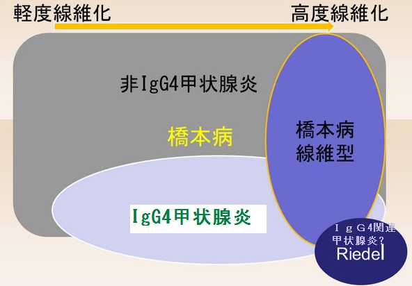 IgG4甲状腺炎(橋本病型IgG4甲状腺炎) IgG4甲状腺炎(橋本病型IgG4甲状腺炎)