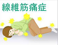 線維筋痛症 線維筋痛症