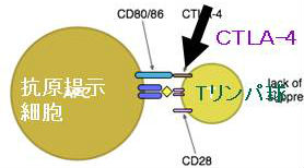 CTLA-4阻害薬オレンシア®(アバタセプト):関節リウマチと橋本病の両方に効果あるか? CTLA-4阻害薬オレンシア®(アバタセプト):関節リウマチと橋本病の両方に効果あるか?