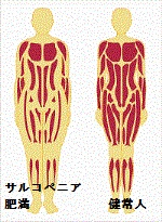 サルコペニア肥満と甲状腺 サルコペニア肥満と甲状腺