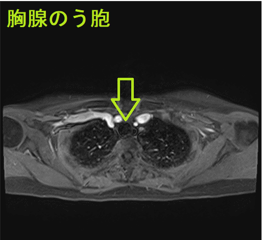 画像診断 : 超音波,CT,MRIを中心とした鑑別診断 : 腫瘍 胃の超音波検査〜胃に対するCT検査・まとめ〜 – Life&TailTV
