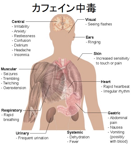 カフェイン中毒 カフェイン中毒