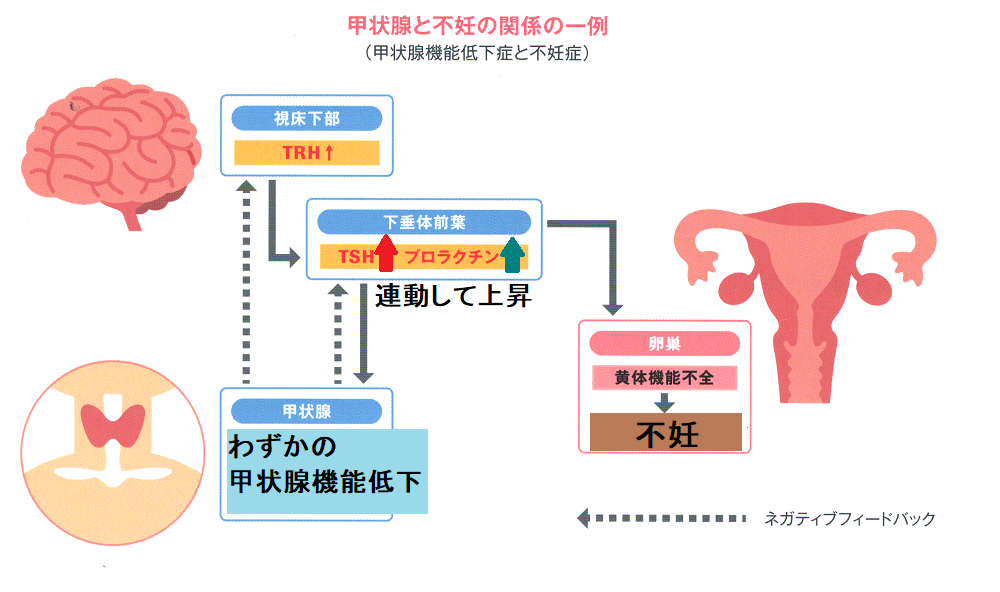 TSH プロラクチン 連動 不妊症/習慣性流産・不育症 TSH プロラクチン 連動 不妊症/習慣性流産・不育症