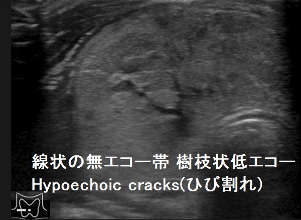 線状の無エコー帯 樹枝状低エコー Hypoechoic cracks(ひび割れ)3 線状の無エコー帯 樹枝状低エコー Hypoechoic cracks(ひび割れ)3