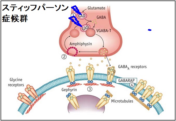 スティッフパーソン症候群 スティッフパーソン症候群