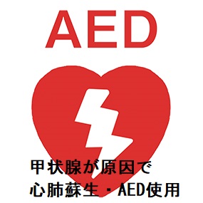 甲状腺が原因で心肺蘇生・AED使用 (電気ショック) 甲状腺が原因で心肺蘇生・AED使用 (電気ショック)