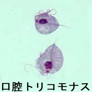 口腔トリコモナス 口腔トリコモナス