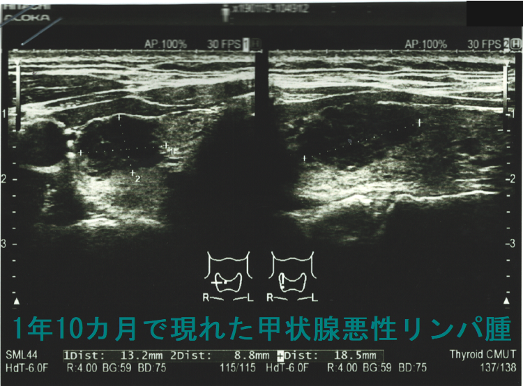 118D47 | medu4でゼロから丁寧に医学を学ぶ