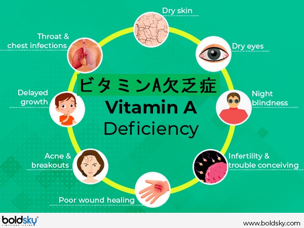 ビタミンA欠乏症 ビタミンA欠乏症