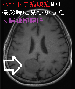 imgrc0103575003.jpg