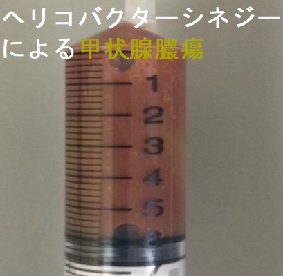 ヘリコバクターシネジーによる甲状腺膿瘍と甲状腺クリーゼ 穿刺液 ヘリコバクターシネジーによる甲状腺膿瘍と甲状腺クリーゼ 穿刺液