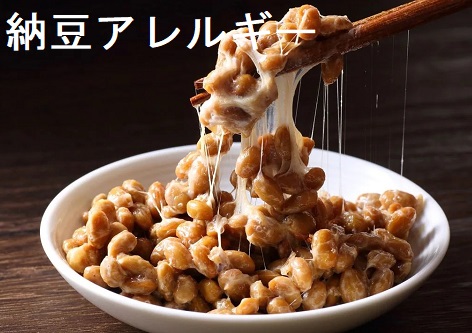 納豆アレルギー 納豆アレルギー