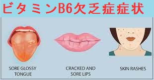 ビタミンB6欠乏症 ビタミンB6欠乏症2