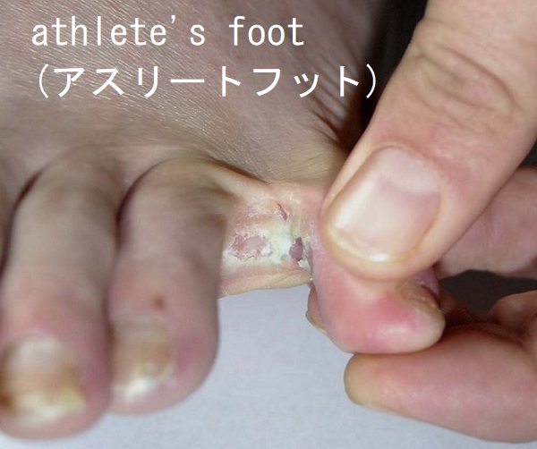 アスリートフット アスリートフット