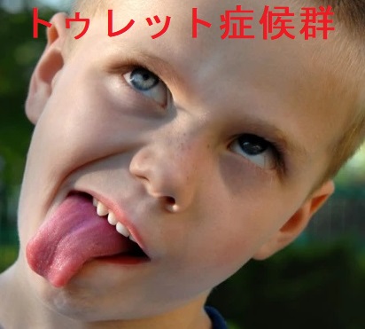 トゥレット症候群 トゥレット症候群