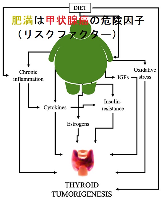 肥満は甲状腺癌の危険因子(リスクファクター) 肥満は甲状腺癌の危険因子(リスクファクター)