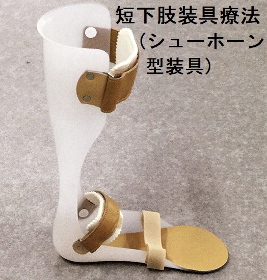 短下肢装具療法(シューホーン型装具) 短下肢装具療法(シューホーン型装具)