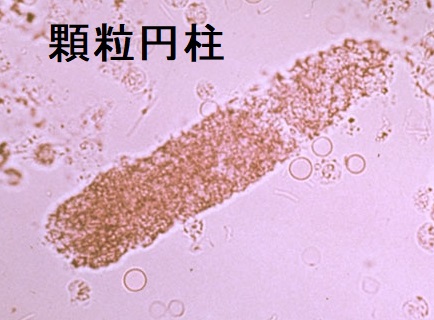 顆粒円柱 顆粒円柱