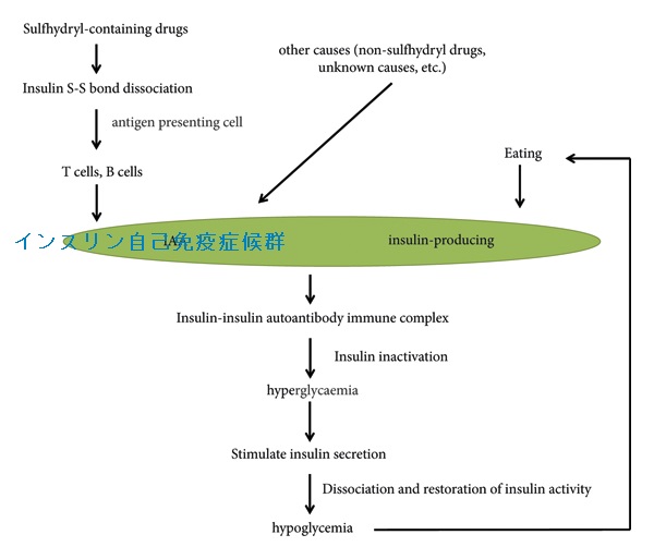 インスリン自己免疫症候群 インスリン自己免疫症候群