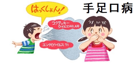 手足口病 手足口病