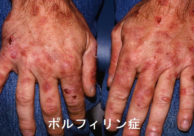 内分泌(ホルモン)の病気(副甲状腺/副腎/下垂体/妊娠・不妊 内分泌(ホルモン)の病気(副甲状腺/副腎/下垂体/妊娠・不妊