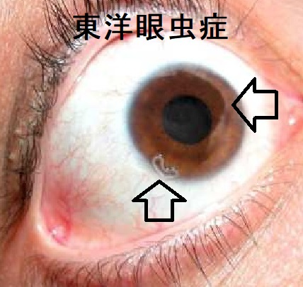 東洋眼虫 東洋眼虫