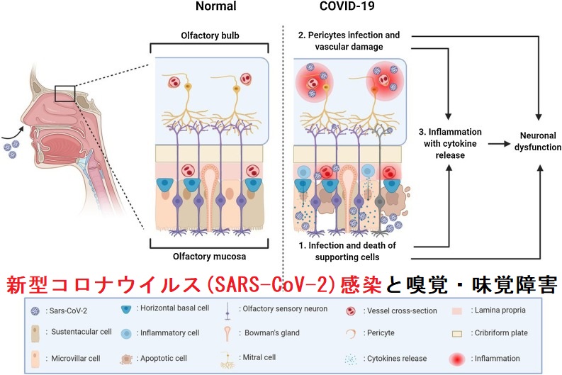 新型コロナウイルス(SARS-CoV-2)感染と嗅覚・味覚障害 新型コロナウイルス(SARS-CoV-2)感染と嗅覚・味覚障害