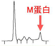 M蛋白血症 M蛋白血症