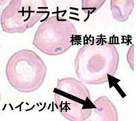 サラセミア サラセミア