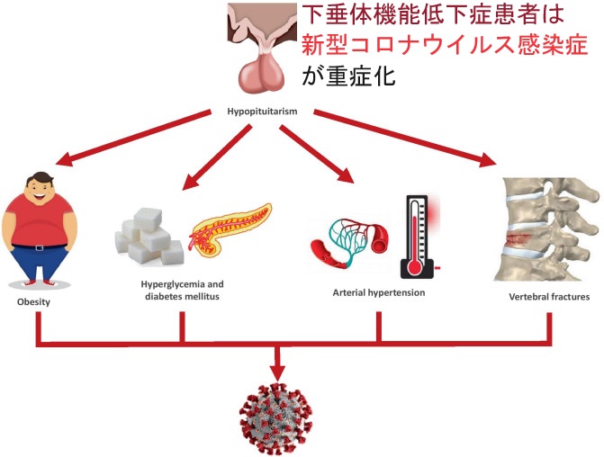 下垂体機能低下症患者は新型コロナウイルス感染(COVID-19)が重症化 下垂体機能低下症患者は新型コロナウイルス感染(COVID-19)が重症化