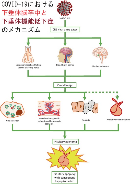 COVID-19における下垂体脳卒中と下垂体機能低下症の病態生理学的メカニズム COVID-19における下垂体脳卒中と下垂体機能低下症の病態生理学的メカニズム