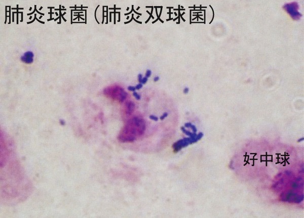 肺炎球菌(肺炎双球菌) 肺炎球菌(肺炎双球菌)