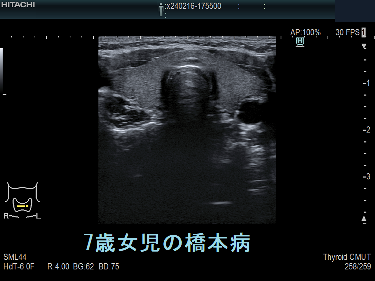 小児超音波診断のすべて メジカルビュー社｜画像医学・放射線医学｜小児超音波診断のすべて