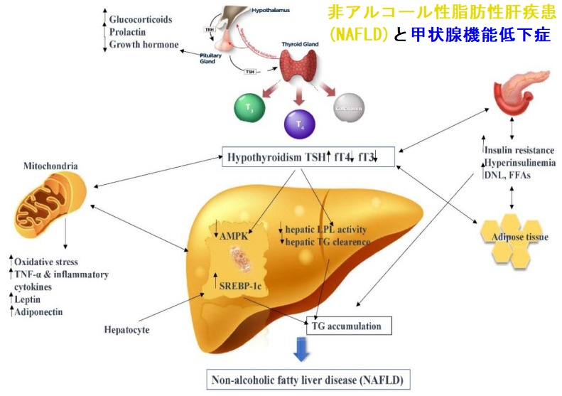 非アルコール性脂肪性肝疾患(NAFLD)と甲状腺機能低下症 非アルコール性脂肪性肝疾患(NAFLD)と甲状腺機能低下症