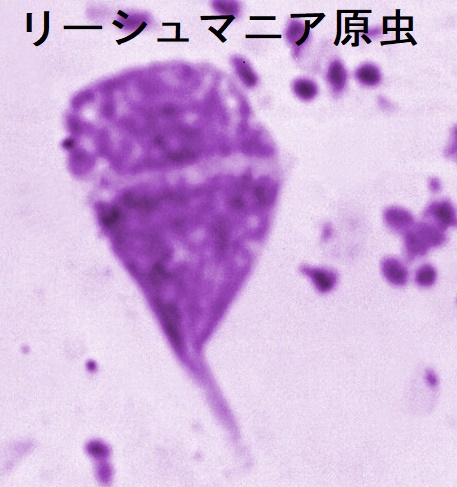 甲状腺/糖尿病と寄生虫 日和見感染[マラリア,糞線虫,ジアルジア 甲状腺/糖尿病と寄生虫 日和見感染[マラリア,糞線虫,ジアルジア