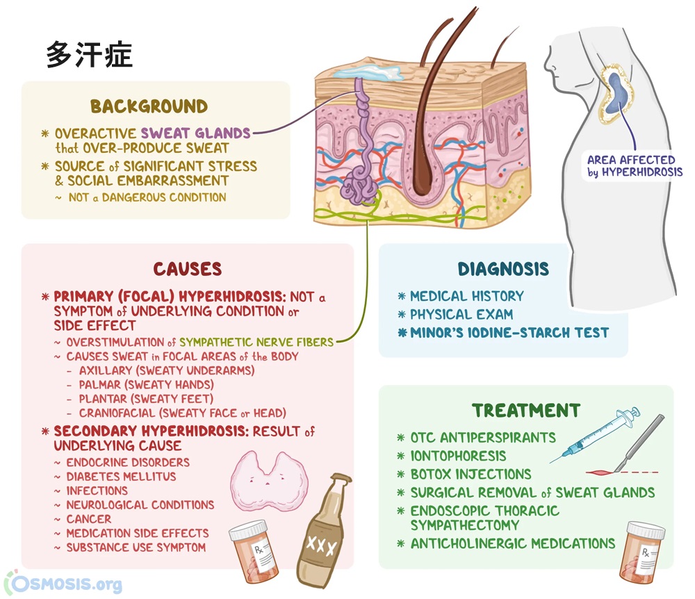 多汗症 多汗症