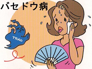 バセドウ病の症状 バセドウ病の症状