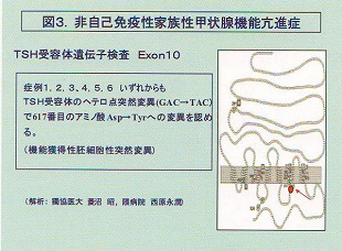 非自己免疫性家族性甲状腺機能亢進症 非自己免疫性家族性甲状腺機能亢進症