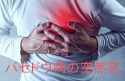 バセドウ病の突然死 バセドウ病の突然死