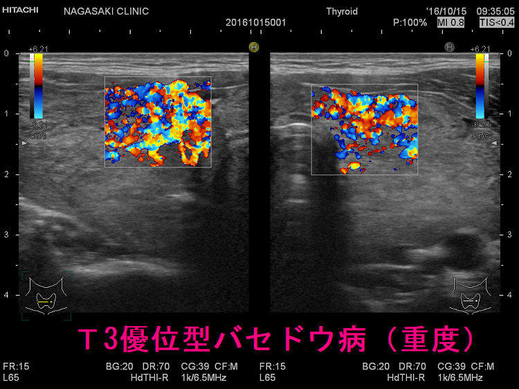 目で見るプリオン病 104I71 | medu4でゼロから丁寧に医学を学ぶ