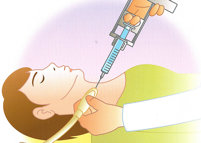穿刺細胞診の注意 穿刺細胞診の注意