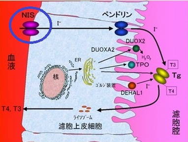 NIS遺伝子異常症 NIS遺伝子異常症