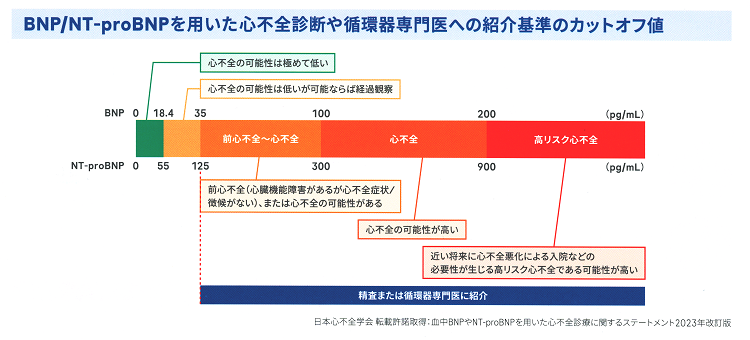 脳性ナトリウム利尿ペプチド(BNP), ヒト脳性ナトリウム利尿ペプチド前駆体N端(NT-proBNP)は心不全の指標 脳性ナトリウム利尿ペプチド(BNP), ヒト脳性ナトリウム利尿ペプチド前駆体N端(NT-proBNP)は心不全の指標