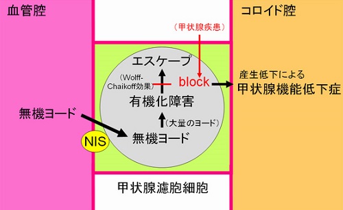 持続性Wolff-Chaikoff効果 持続性Wolff-Chaikoff効果