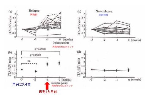 出産後バセドウ病が再発する時は下甲状腺動脈の収縮期最大血流速度(ITA-PSV)が最初に上昇 出産後バセドウ病が再発する時は下甲状腺動脈の収縮期最大血流速度(ITA-PSV)が最初に上昇