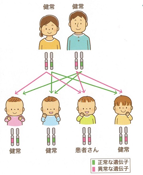 先天性・遺伝性甲状腺機能低下症、NIS・TPO・DUOX2 遺伝子変異[長崎