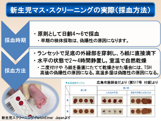 新生児マススクリーニングの手順 新生児マススクリーニングの手順